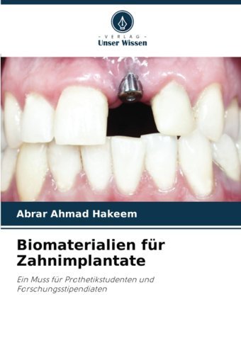 Biomaterialien Für Zahnimplantate: Ein Muss Für Prothetikstudenten Und Forschungsstipendiaten Hakeem, Abrar Ahmad Verlag Unser Wissen