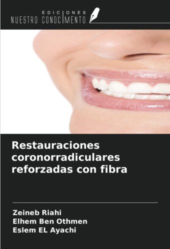 Restauraciones Coronorradiculares Reforzadas Con Fibra Riahi, Zeineb Ediciones Nuestro Conocimiento