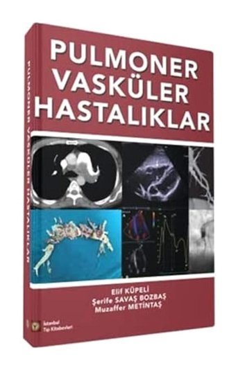 Pulmoner Vasküler Hastalıklar Muzaffer Metintaş İstanbul Tıp Kitabevi