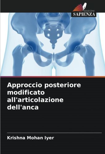 Approccio Posteriore Modificato All'Articolazione Dell'Anca Iyer, Krishna Mohan Edizioni Sapienza