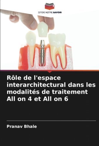 Rle De L'Espace İnterarchitectural Dans Les Modalits De Traitement All On 4 Et All On 6 Bhale, Pranav Editions Notre Savoir