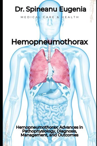 Hemopneumothorax: Advances İn Pathophysiology, Diagnosis, Management, And Outcomes Eugenia, Dr. Spineanu Independently Publıshed