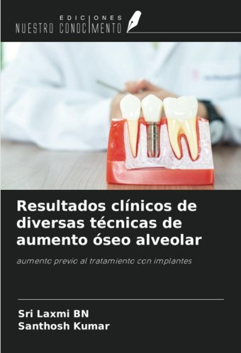 Resultados Clnicos De Diversas Tcnicas De Aumento Seo Alveolar: Aumento Previo Al Tratamiento Con İmplantes Bn, Sri Laxmi Ediciones Nuestro Conocimiento