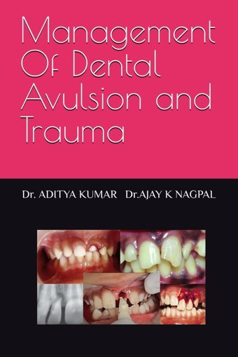 Management Of Dental Avulsion And Trauma Kumar, Dr. Aditya Independently Publıshed