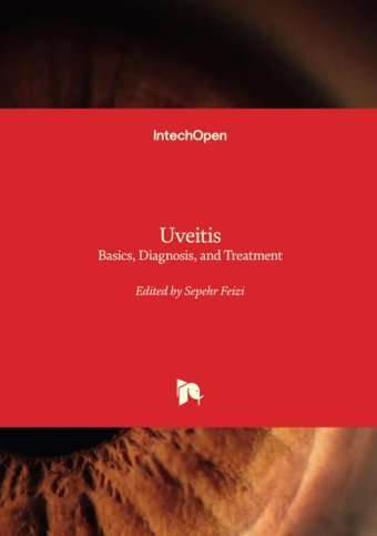 Uveitis: Basics, Diagnosis, And Treatment Intechopen