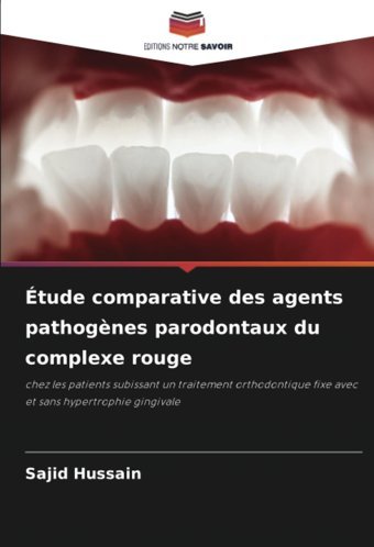 Tude Comparative Des Agents Pathognes Parodontaux Du Complexe Rouge: Chez Les Patients Subissant Un Traitement Orthodontique Fixe Avec Et Sans Hypertrophie Gingivale Hussain, Sajid Editions Notre Savoir