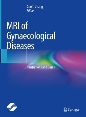 Mrı Of Gynaecological Diseases: Illustrations And Cases Springer
