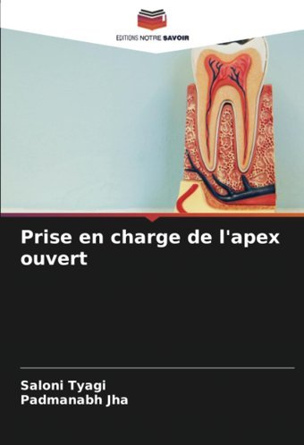 Prise En Charge De L'Apex Ouvert Tyagi, Saloni Editions Notre Savoir