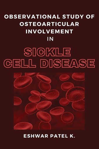 Observational Study Of Osteoarticular Involvement İn Sickle Cell Disease K, Eshwar Patel Independent Author
