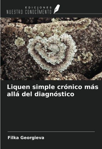 Liquen Simple Crnico Ms All Del Diagnstico Georgieva, Filka Ediciones Nuestro Conocimiento