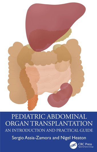 Pediatric Abdominal Organ Transplantation: An Introduction And Practical Guide Assia-Zamora, Sergio Crc Press Inc