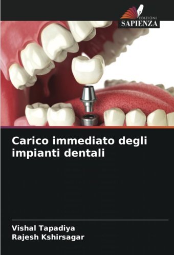 Carico İmmediato Degli İmpianti Dentali Tapadiya, Vishal Edizioni Sapienza