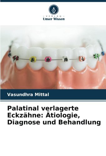 Palatinal Verlagerte Eckzhne: Tiologie, Diagnose Und Behandlung: De Mittal, Vasundhra Verlag Unser Wissen