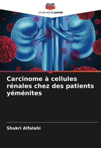 Carcinome Cellules Rnales Chez Des Patients Ymnites Alfalahi, Shukri Editions Notre Savoir