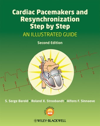 Cardiac Pacemakers And Resynchronization Step By Step: An Illustrated Guide Barold, S. Serge Wiley-Blackwell
