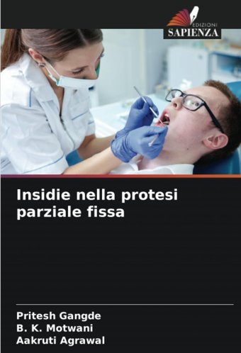Insidie Nella Protesi Parziale Fissa: De Gangde, Pritesh Edizioni Sapienza