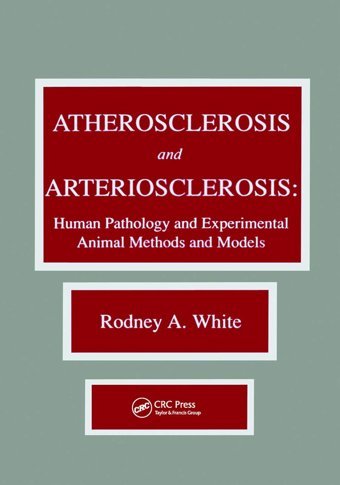 Atherosclerosis And Arteriosclerosis White, Rodney A. Crc Press Inc