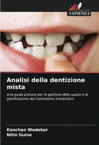 Analisi Della Dentizione Mista: Una Guida Precoce Per La Gestione Dello Spazio E La Pianificazione Del Trattamento Ortodontico Wadekar, Kanchan Edizioni Sapienza
