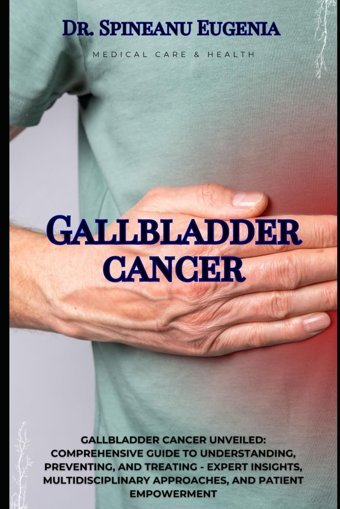 Gallbladder Cancer Unveiled: Comprehensive Guide To Understanding, Preventing, And Treating Expert Insights, Multidisciplinary Approaches, And Patient Empowerment Eugenia, Dr. Spineanu Independently Publıshed