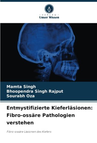 Entmystifizierte Kieferlsionen: Fibro-Ossre Pathologien Verstehen: Fibro-Ossre Lsionen Des Kiefers Singh, Mamta Verlag Unser Wissen