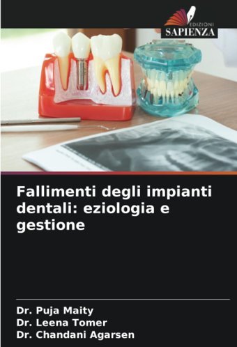 Fallimenti Degli İmpianti Dentali: Eziologia E Gestione Maity, Dr. Puja Edizioni Sapienza