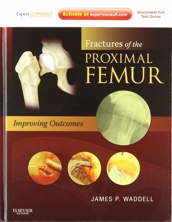 Fractures Of The Proximal Femur: Improving Outcomes: Expert Consult: Online And Print Waddell, James P. Saunders