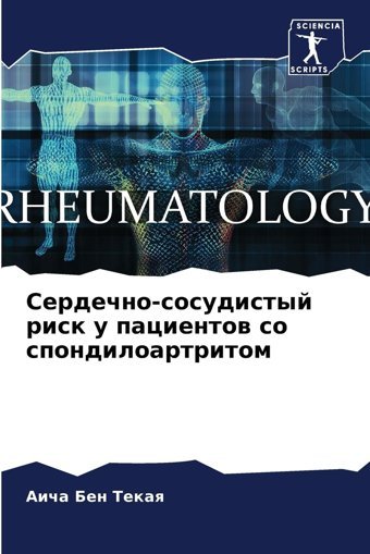 Serdechno-Sosudistyj Risk U Pacientow So Spondiloartritom Ben Tekaq, Aicha Sciencia Scripts
