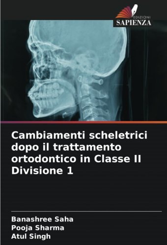 Cambiamenti Scheletrici Dopo İl Trattamento Ortodontico İn Classe Iı Divisione 1: De Saha, Banashree Edizioni Sapienza