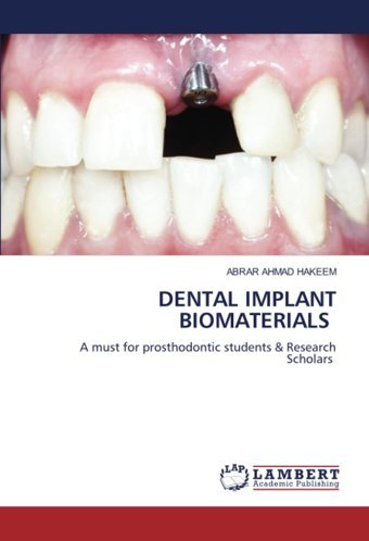 Dental Implant Bıomaterıals: A Must For Prosthodontic Students & Research Scholars Hakeem, Abrar Ahmad Lap Lambert Academic Publishing