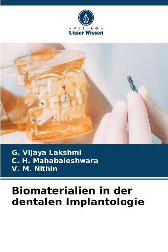 Biomaterialien İn Der Dentalen Implantologie Vijaya Lakshmi, G. Verlag Unser Wissen