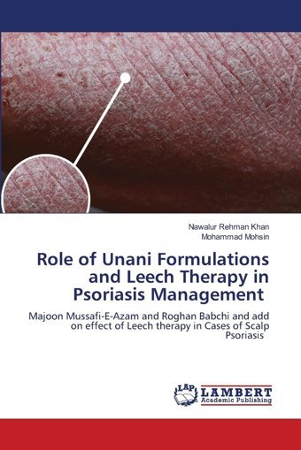 Role Of Unani Formulations And Leech Therapy İn Psoriasis Management: Majoon Mussafi-E-Azam And Roghan Babchi And Add On Effect Of Leech Therapy İn Leech Therapy İn Cases Of Scalp Psoriasis.De Khan, Nawalur Rehman Lap Lambert Academic Publishing