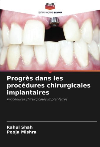 Progrs Dans Les Procdures Chirurgicales İmplantaires: Procdures Chirurgicales İmplantaires Shah, Rahul Editions Notre Savoir