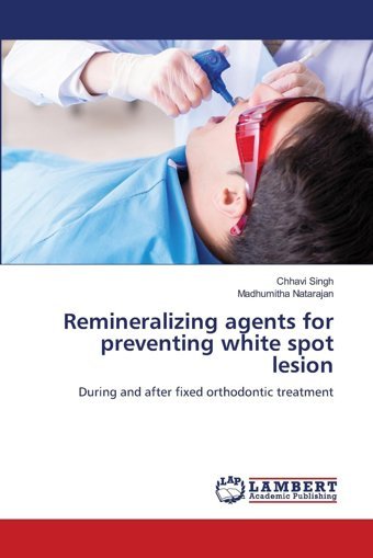 Remineralizing Agents For Preventing White Spot Lesion: During And After Fixed Orthodontic Treatment Singh, Chhavi Lap Lambert Academic Publishing