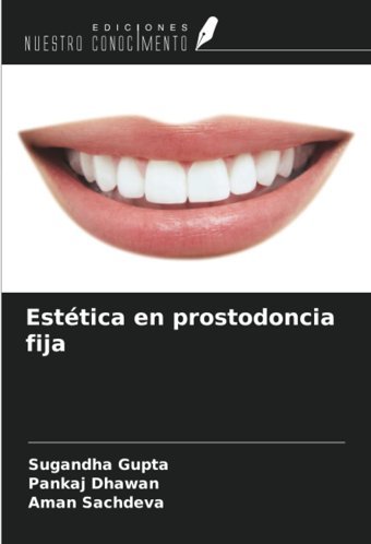 Esttica En Prostodoncia Fija Gupta, Sugandha Ediciones Nuestro Conocimiento