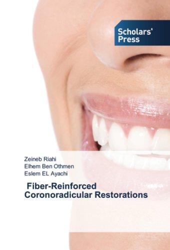 Fiber-Reinforced Coronoradicular Restorations: De Riahi, Zeineb Scholars' Press