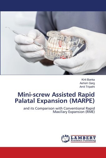 Mini-Screw Assisted Rapid Palatal Expansion (Marpe): And İts Comparison With Conventional Rapid Maxillary Expansion (Rme) Banka, Kirti Lap Lambert Academic Publishing