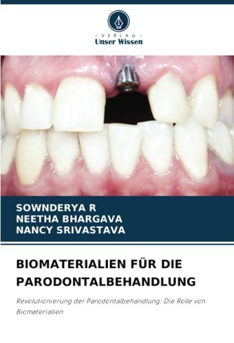 Bıomaterıalıen Für Dıe Parodontalbehandlung: Revolutionierung Der Parodontalbehandlung: Die Rolle Von Biomaterialien R, Sownderya Verlag Unser Wissen