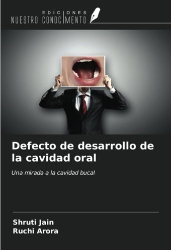 Defecto De Desarrollo De La Cavidad Oral: Una Mirada A La Cavidad Bucal Jain, Shruti Ediciones Nuestro Conocimiento
