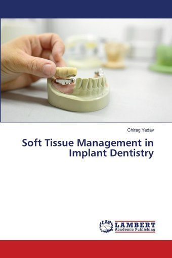 Soft Tissue Management İn Implant Dentistry Yadav, Chirag Lap Lambert Academic Publishing
