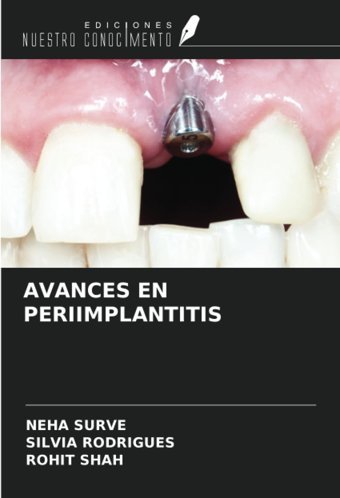 Avances En Perıımplantıtıs Surve, Neha Ediciones Nuestro Conocimiento