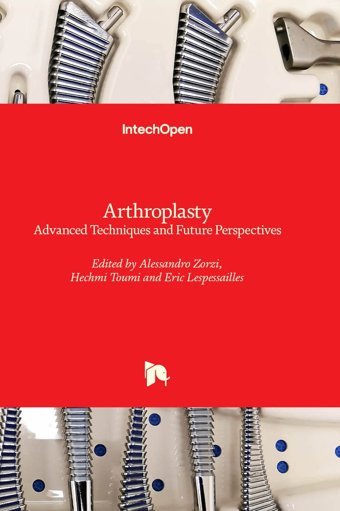 Arthroplasty Advanced Techniques And Future Perspectives Intechopen