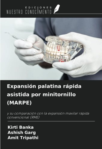 Expansin Palatina Rpida Asistida Por Minitornillo (Marpe): Y Su Comparacin Con La Expansin Maxilar Rpida Convencional (Rme) Banka, Kirti Ediciones Nuestro Conocimiento