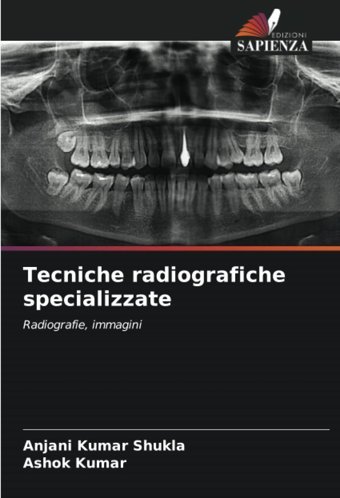 Tecniche Radiografiche Specializzate: Radiografie, İmmagini Shukla, Anjani Kumar Edizioni Sapienza