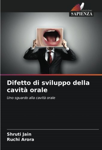 Difetto Di Sviluppo Della Cavit Orale: Uno Sguardo Alla Cavit Orale Jain, Shruti Edizioni Sapienza