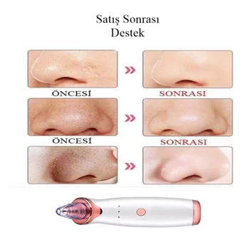 Vontar Tüm Ciltler İçin 5 Başlıklı Şarjlı Vakumlu Yüz Temizleme Cihazı Beyaz