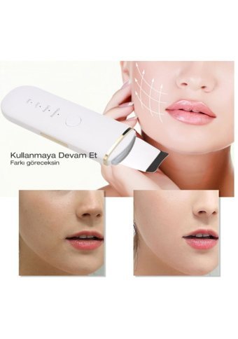 Ultrasonik Gmx1017798 Tüm Ciltler İçin 1 Başlıklı Şarjlı Titreşimli Yüz Temizleme Cihazı Beyaz
