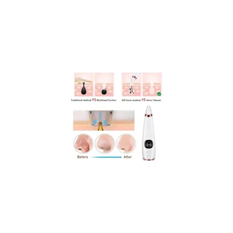 Xinh Blackhead 850 mAH Tüm Ciltler İçin 6 Başlıklı Şarjlı Vakumlu Yüz Temizleme Cihazı Beyaz Rose Gold