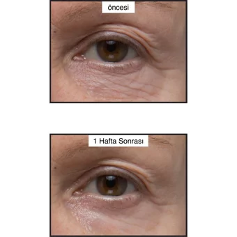 Murad Renewing Tüm Ciltler için Göz Çevresi Krem Pompalı 15 ml