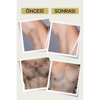 Ornate Karınca Yumurtası Yağlı Tüm Ciltler İçin Tüm Vücut Genital Bölge Unisex Tüy Dökücü Sprey 155 ml