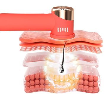 Foreo Peach 2 Go 500000 Atımlı Yüz Koltuk Altı Genital Bölge Tüm Vücut İçin Tek Başlıklı IPL Lazer Epilasyon Aleti Turuncu